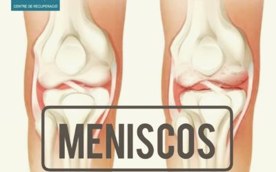 Meniscos del genoll